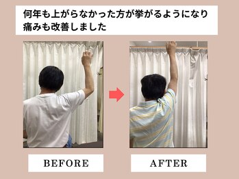 富雄みなみ整骨院/施術後ビフォーアフター