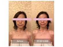 リンパケア顔筋美容のフフ(ff)の雰囲気（before→after）