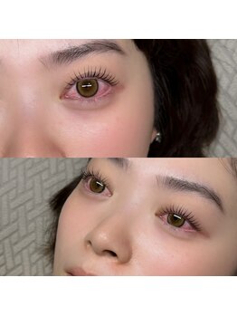 ククナ(KUKUNA)の写真/【どんなお目元もお任せください☆】コンプレックスの解消はもちろんお目元の理想を叶えます★