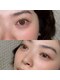 ククナ(KUKUNA)の写真/【どんなお目元もお任せください☆】コンプレックスの解消はもちろんお目元の理想を叶えます★
