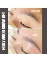 セラス(CERAS)/ハリウッドブロウリフト