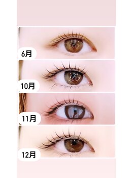 イト(ito)/Lashaddict Before After