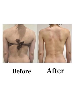 ルアバイアロ(Lua by Alo's)/上半身ダイエット