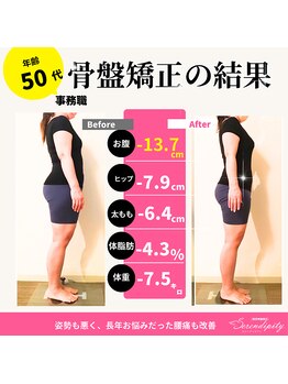 セレンディピティ 稲沢店(serendipity)/50代 骨盤ダイエットの結果