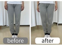 ナオル整体 大里院(NAORU整体)/女性　O脚のビフォーアフター