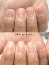 マリーロール 梅田店(Marie Laure)/深爪矯正/自爪育成/ネイルケア