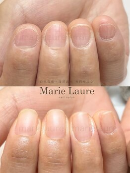 マリーロール 梅田店(Marie Laure)/深爪矯正/自爪育成/ネイルケア