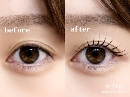 ミイン(miin)の写真