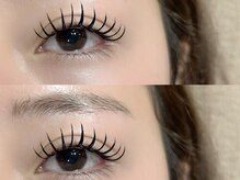 エマ(EMA)/丁寧なカウンセリングに定評あり