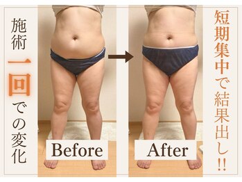 ヨサパーク ホロムア(YOSA PARK*Holomua)