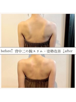 シェデル(SHEDEL Spa)の写真/深部のコリから根本改善＆皮下脂肪燃焼とコラーゲンUPで引き締め◎一度の施術でも楽になると感動の声多数☆