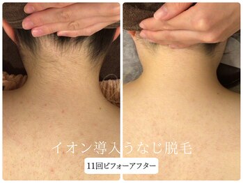 リノ(Lino)/うなじ脱毛シェービング付♪