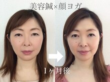 ユイユイマール(Yui Yui Maru)