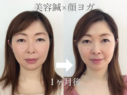 ユイユイマール(Yui Yui Maru)の写真