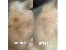 ココスタイルビューティー(COCOSTYLE beauty)