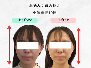 美容整体 ウェリナ 蟹江院/小顔矯正/骨盤矯正/痩身整体