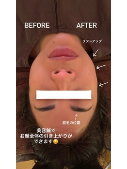 ロノ(Lono)の写真/女性鍼灸師による女性専用サロンで自分時間を。自分の体と向き合う時間を。