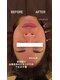 ロノ(Lono)の写真/女性鍼灸師による女性専用サロンで自分時間を。自分の体と向き合う時間を。