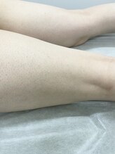 ナノハナ/鹿沼市の全身脱毛美容室ナノハナ