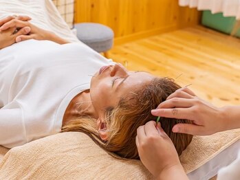 ハリルナ(hari.luna)/美容鍼、頭にも打ちます