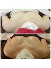 カナエルサロン 旭川(KANAERU SALON)/【バストアップ】症例☆