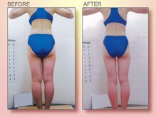 ジュリア オージェ 梅田店/ビフォーアフター（美脚コース)
