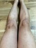 【メンズフェイシャル】フェイシャルワックス脱毛1回¥7700！男性限定！
