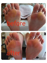 ビソク(VISOK)/美肌コースです