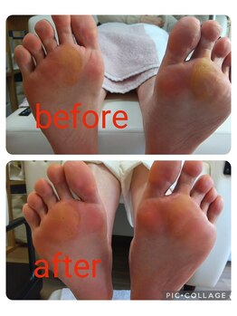 ビソク(VISOK)/美肌コースです