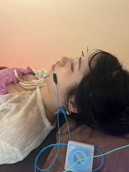 ハリファ鍼灸院 福岡博多院(HariFa鍼灸院)/施術風景