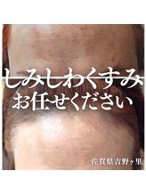 カンフリエ 吉野ヶ里店(Camphrier) 毛穴開き 徹底改善