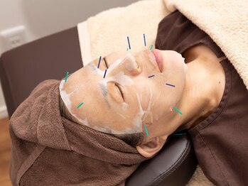 押上駅前整骨院/幹細胞パック