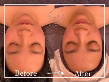 R-1ビューティーサロン 表参道/Before&After