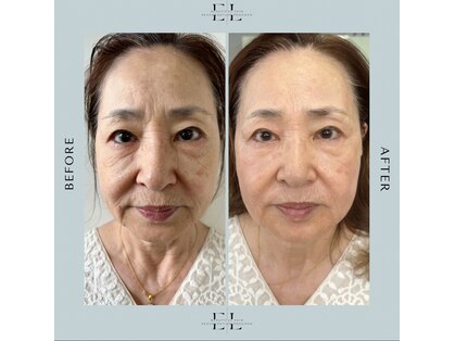 リチェルカ(ricerca)の写真