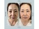 リチェルカ(ricerca)の写真