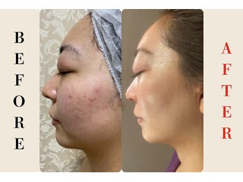 ウィズハーヴェ(w/haave)/まるで別人♪