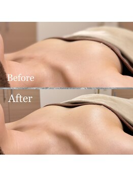 プリマベラ 大阪梅田(primabella)/スタンダードバスト１回目