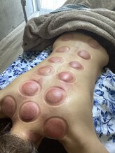 サクランボ(SAKURAMBO)/お疲れ度がわかる☆カッピング