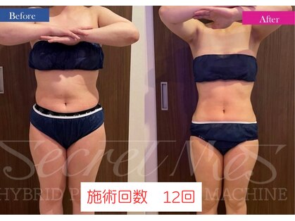 リュウヴィ(Ryuvi)の写真