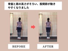 富雄みなみ整骨院/施術後ビフォーアフター