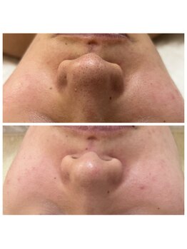 ルルボーテ(Loulou Beaute)/waxxxx