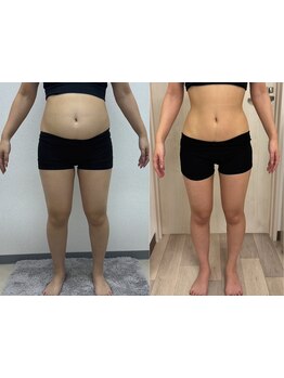 くびれを手に入れたい