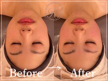 R-1ビューティーサロン 表参道/Before＆After