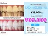 【当店限定♪】3週間通い放題フリーパス◎セルフホワイトニング1回40分照射♪