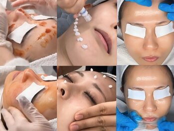 スア(SUA)の写真/韓国ブランド★美容アンプル導入！！全ての肌悩みに合わせて数種類の韓国美容アンプルをご用意◎