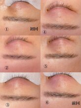 アイラッシュ リップル(Eyelash ripplu)/ブロウアディクトサロンケア