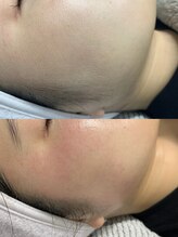 ジュリア(JULIA)/フェイスWAX（ワックス）