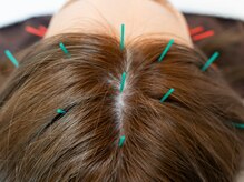 カルナ(CARUNA.)の雰囲気（◇HARIヘッド◇はりとマッサージでヘッドスパ）