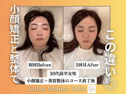 ルルラボ(LuLu beauty labo)の写真