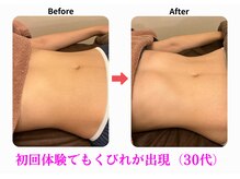 エーシーサロン 六本木店(acsalon)/遺伝子解析なしでもこの変化！